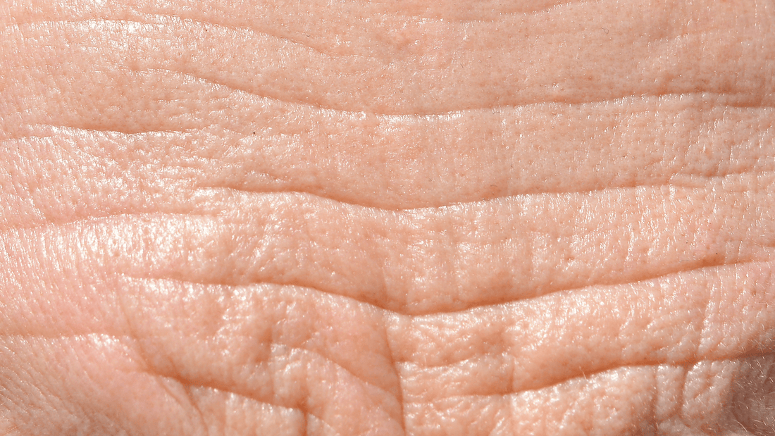 Close-up of mature skin showing visible fine lines and wrinkles, representing the signs of aging and the need for effective skincare treatments.
