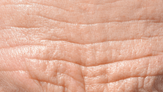 Close-up of mature skin showing visible fine lines and wrinkles, representing the signs of aging and the need for effective skincare treatments.