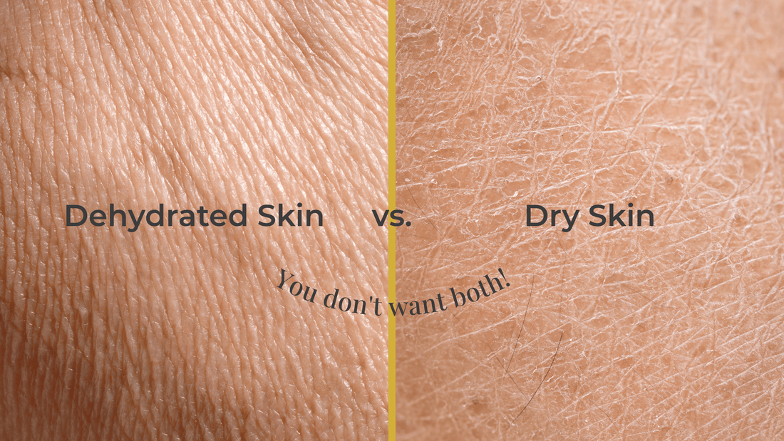 Close-up visual comparison between dehydrated skin and dry skin, highlighting texture differences with the caption "You don't want both!"