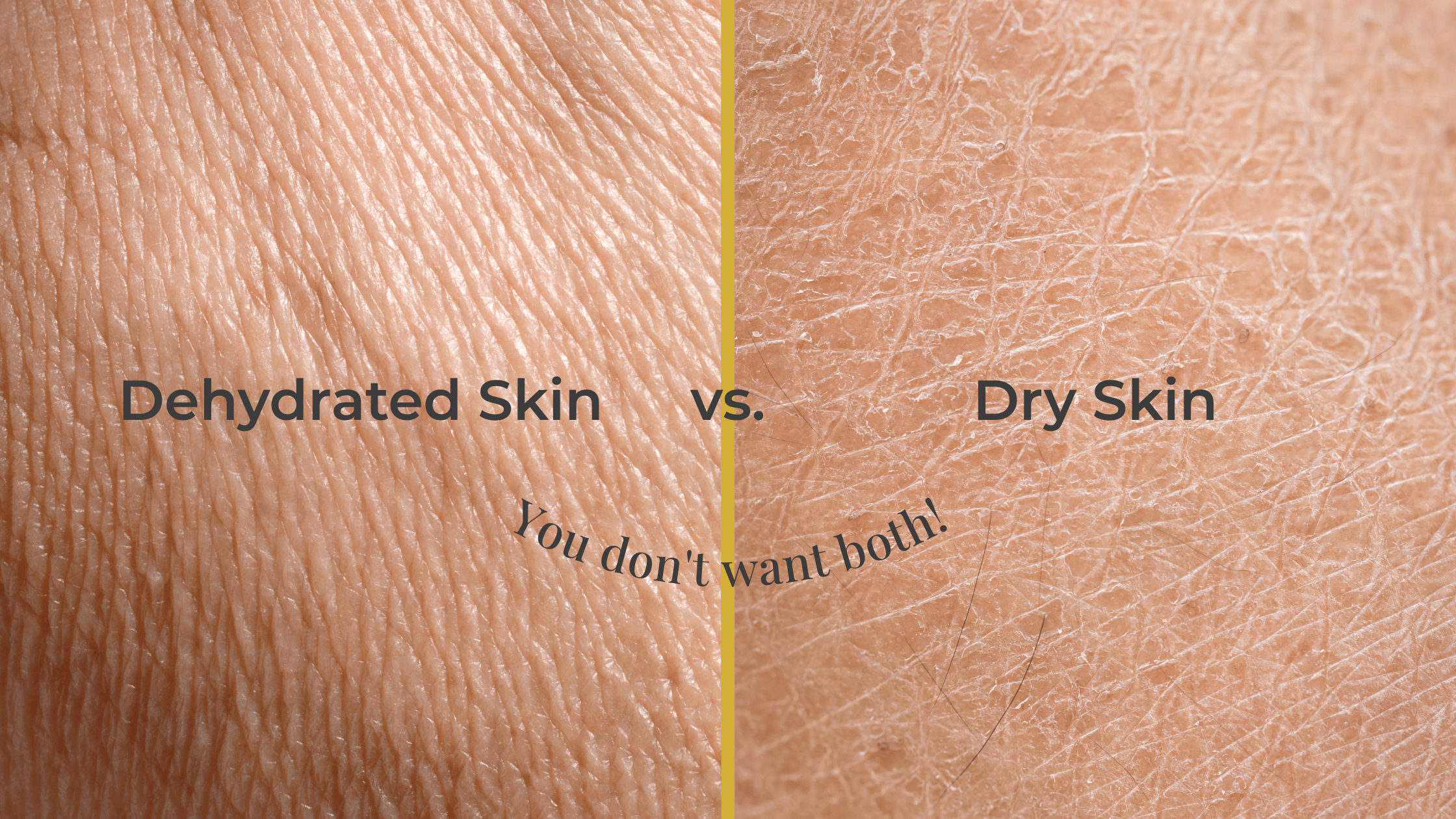 Dehydrated vs Dry Skin: Essential Guide to Healthy Skin | YUGA skincare